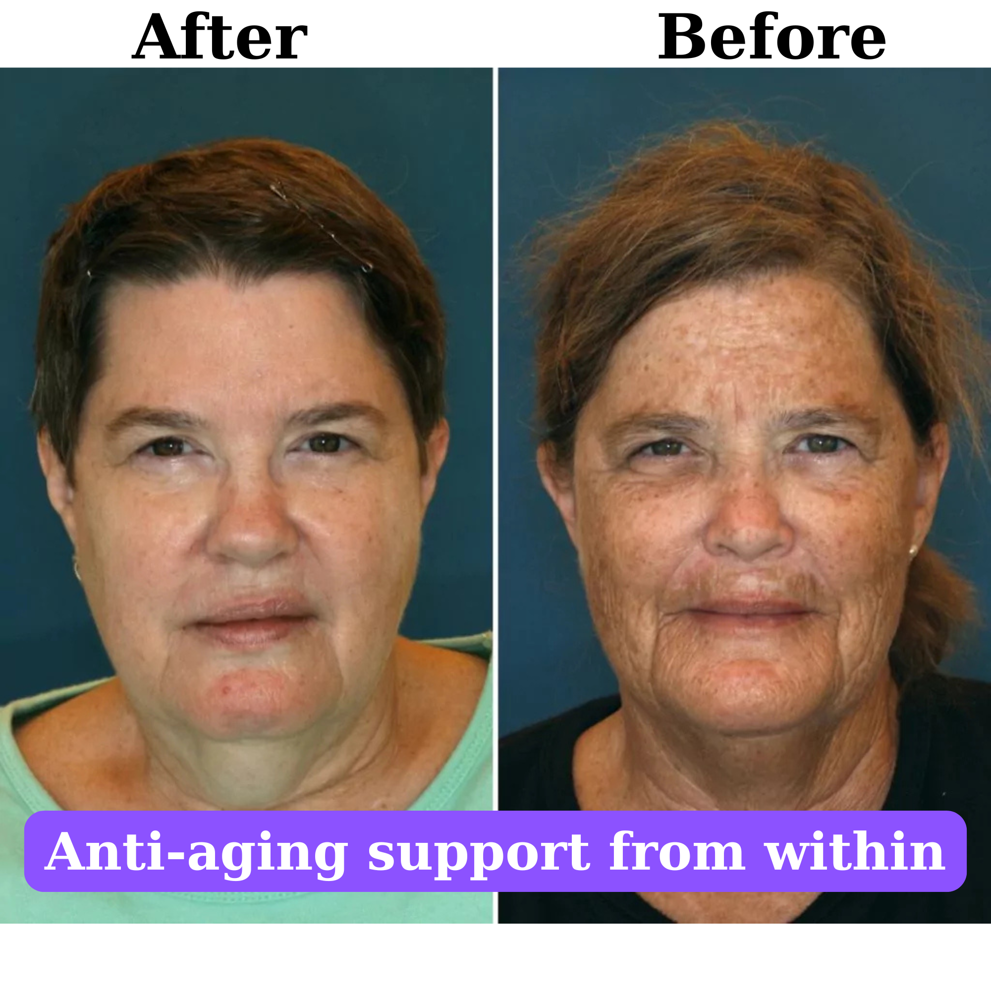 AgeLess+™ Anti-Aging, Youthful Energy & Cellular Renewal Complex